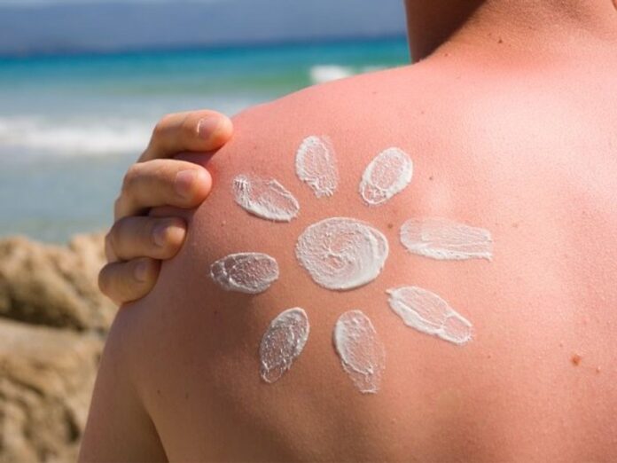 How long does sunburn last